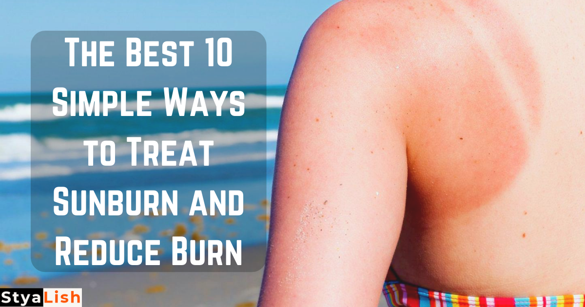 The Best 10 Simple Ways to Treat Sunburn and Reduce Burn